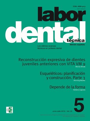 cover image of Labor Dental Técnica Volume22 Ene-Feb 2019 nº5